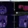 Acteon X-Mind Trium 3D Cone Beam + Panoramic X-Ray