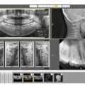 RayScan 3D EDGE Panoramic X-ray