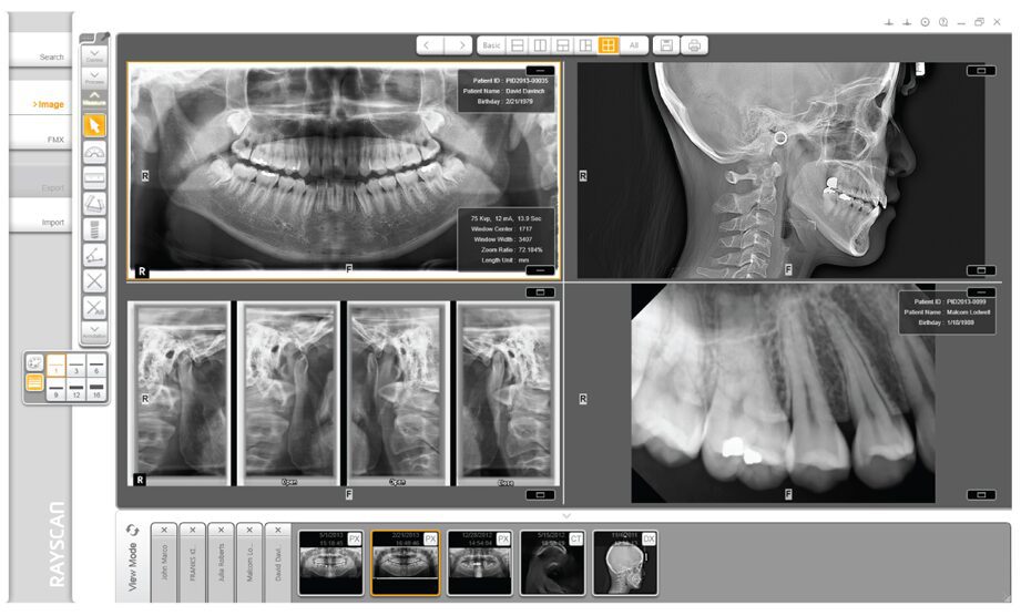 RayScan 3D EDGE Panoramic X-ray