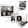 RayScan 3D EDGE Panoramic X-ray