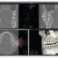 RayScan 3D EDGE Panoramic X-ray