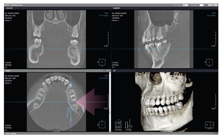 RayScan 3D EDGE Panoramic X-ray