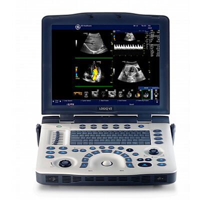 GE Logiq V2 Ultrasound Machine